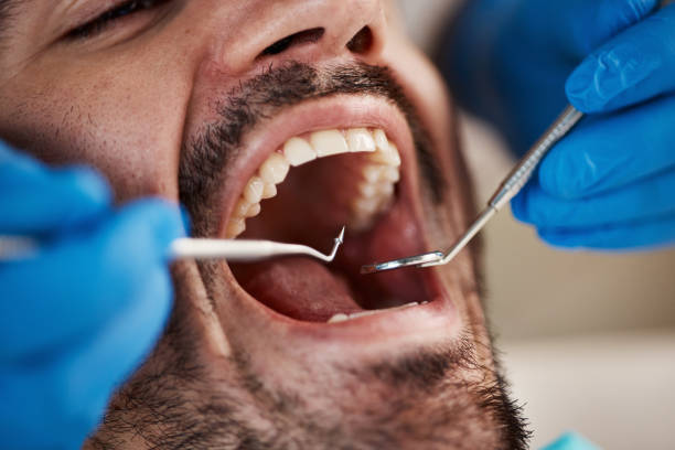 Best Emergency Dental Care for Broken or Chipped Teeth in Pennville, PA
